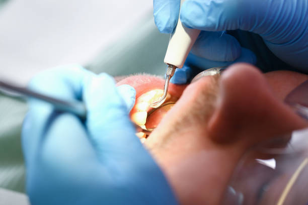 Best Emergency Broken Tooth Repair in Richland, MS