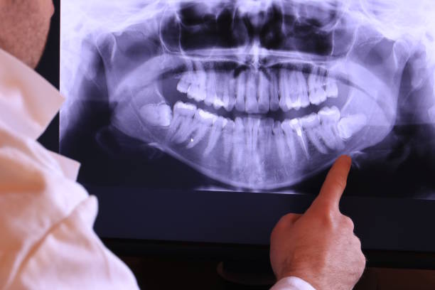 Best Emergency Tooth Extraction in Richland, MS